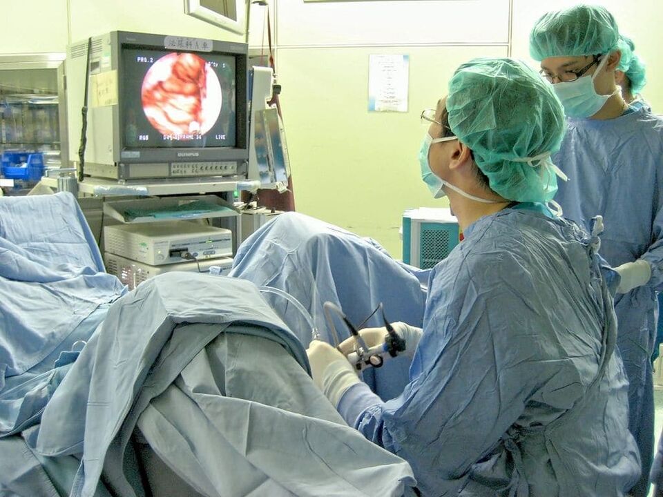 traitement chirurgical de la prostatite calculeuse