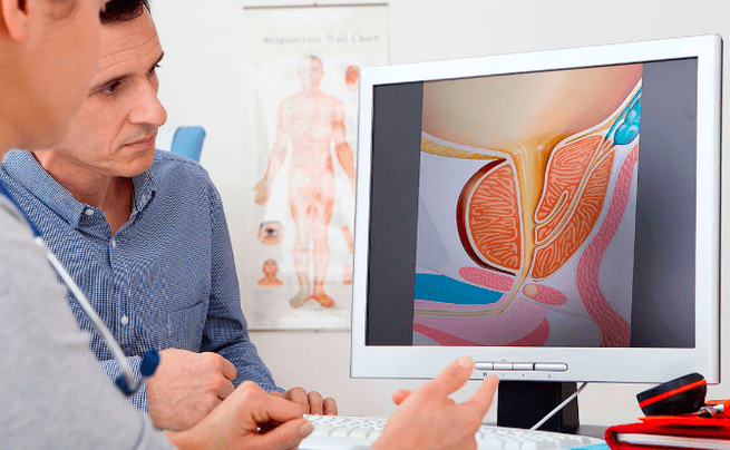 Diagnostic de prostatite
